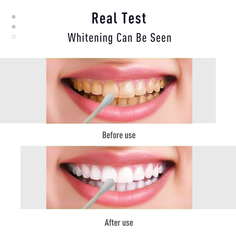 Caneta de Clareamento Dental - Whitening Kit